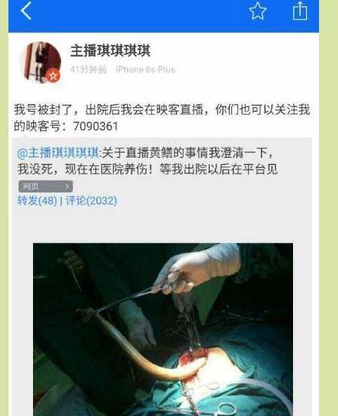 大胆人体毛片的相关介绍